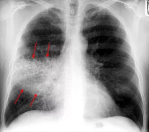 Radiologiya quiz şəkli